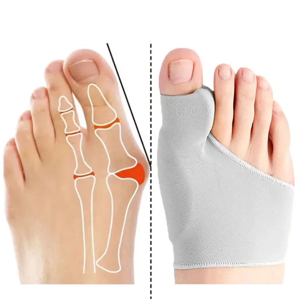 Correcteur d'hallux valgus, séparateur d'orteils pour la relaxation, l'écartement et l'étirement du gros orteil, support pour l'hallux valgus et l'hallux valgus, protecteur pour les gros orteils