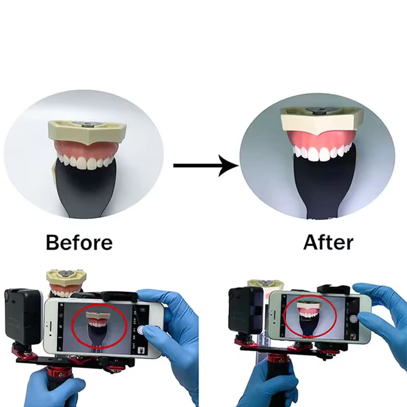 Lampe buccale pour dentiste
