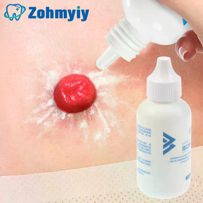 Farine de soins pour la peau, 25g, farine sèche, traitement médical pour le stomie, accessoire, sac de colostomie, fourniture de produits de soins de protection