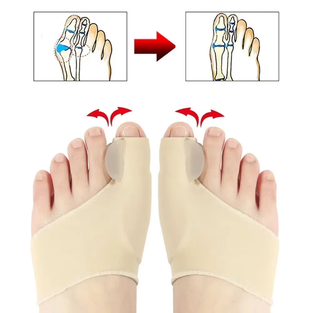 Correcteur d'hallux valgus, séparateur d'orteils pour la relaxation, l'écartement et l'étirement du gros orteil, support pour l'hallux valgus et l'hallux valgus, protecteur pour les gros orteils